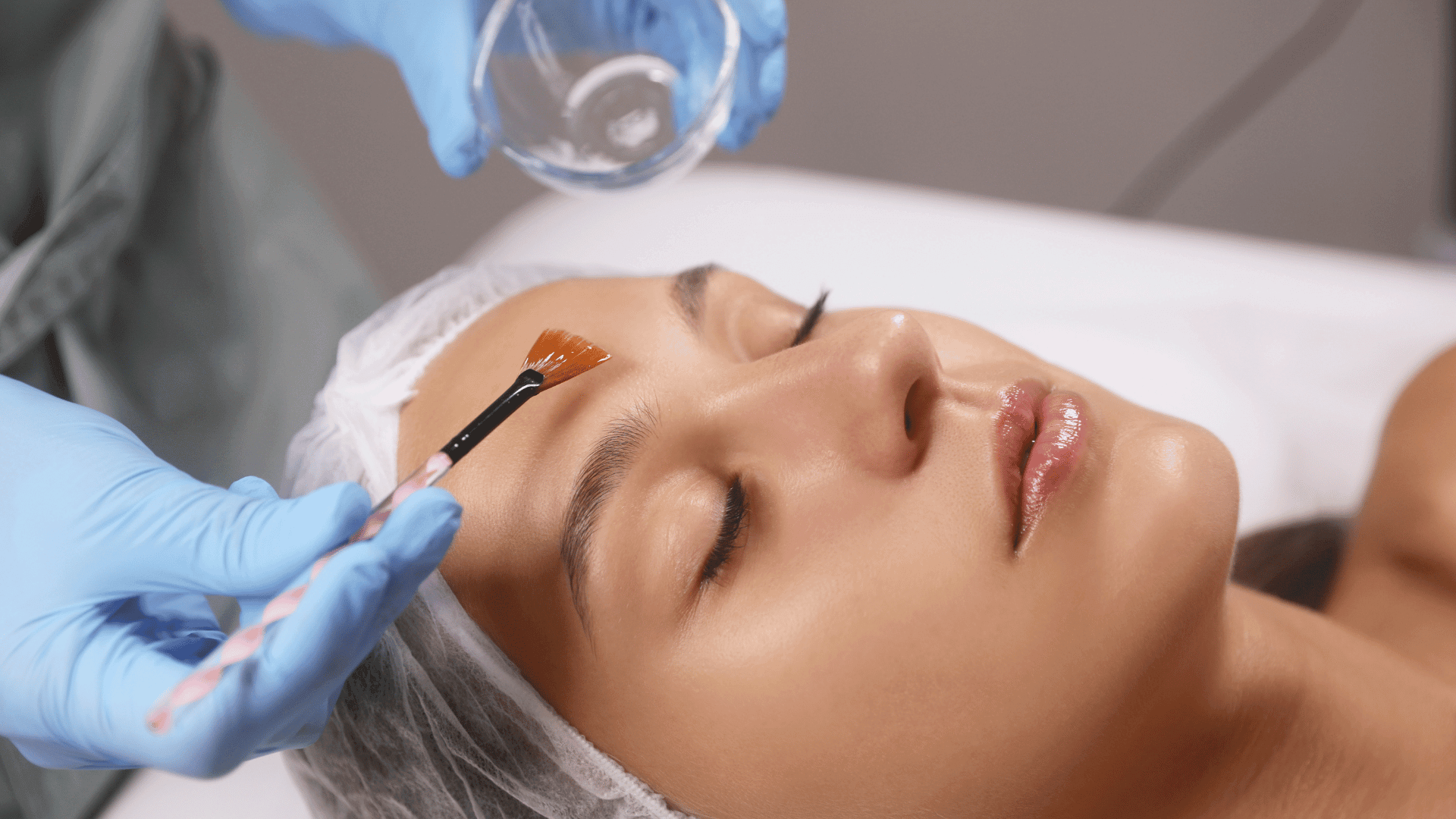 Peeling químico en Torremolinos · Centro Ubud