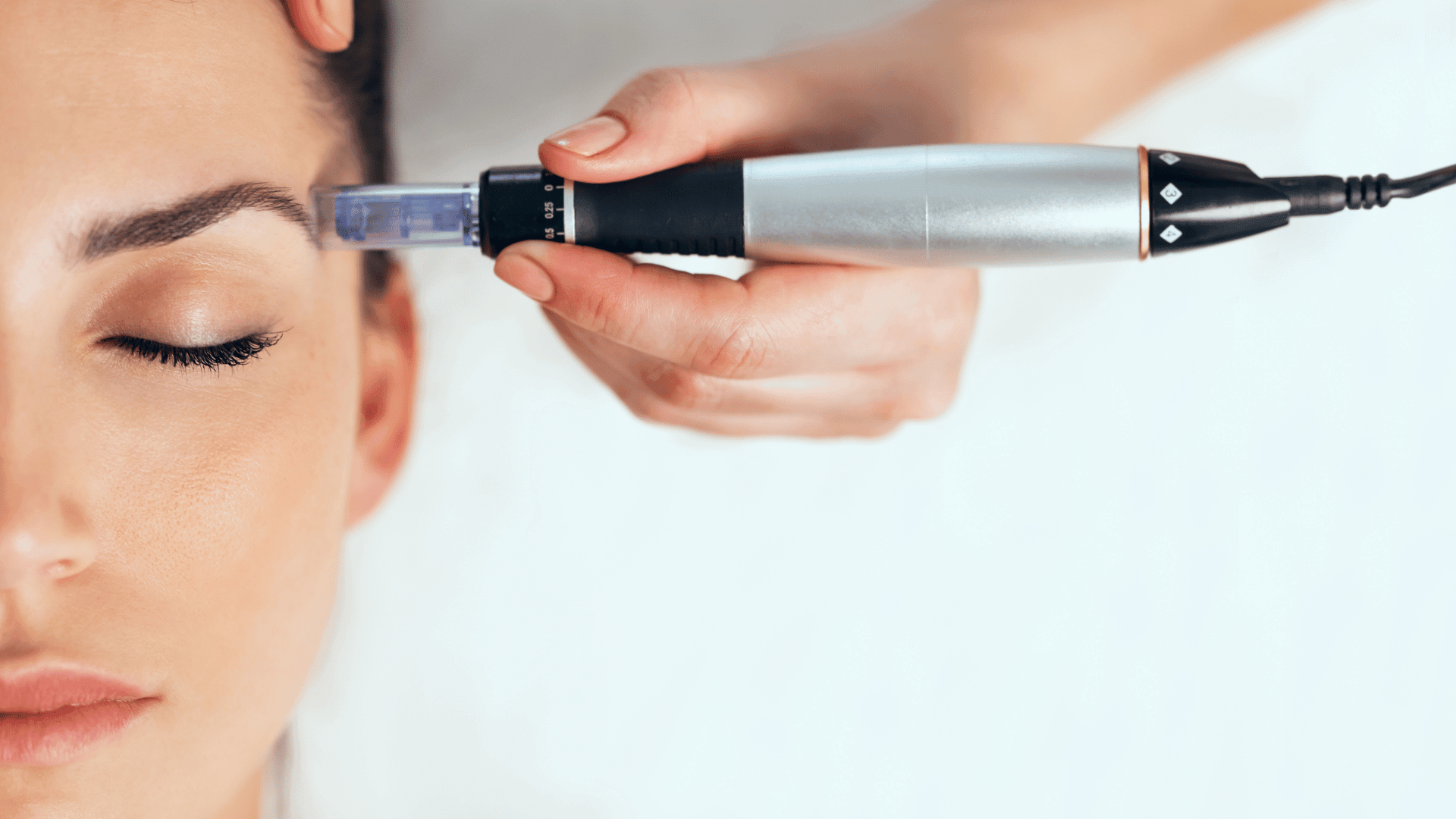 Dermapen en Torremolinos · Centro Ubud