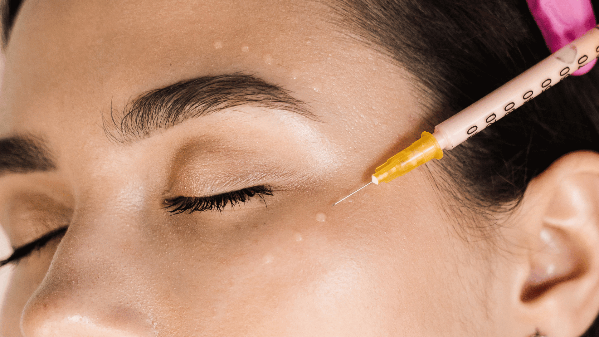 Mesoterapia facial en Torremolinos · Centro Ubud