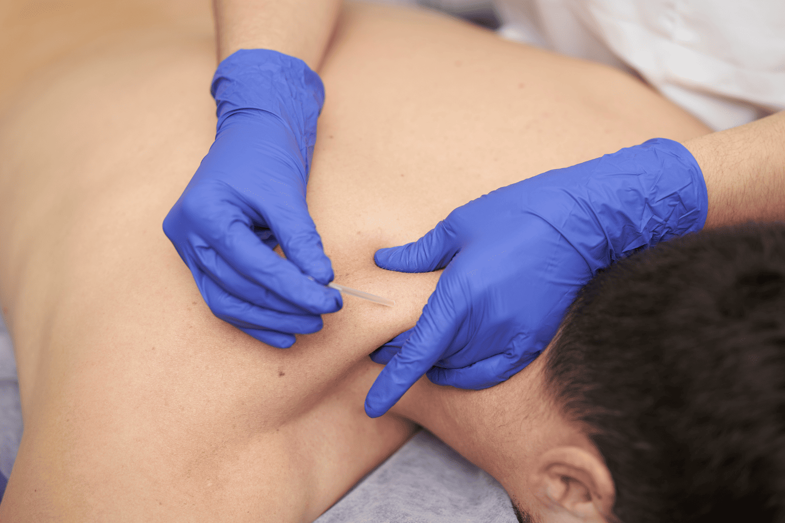 Fisioterapia invasiva en Torremolinos · Centro Ubud