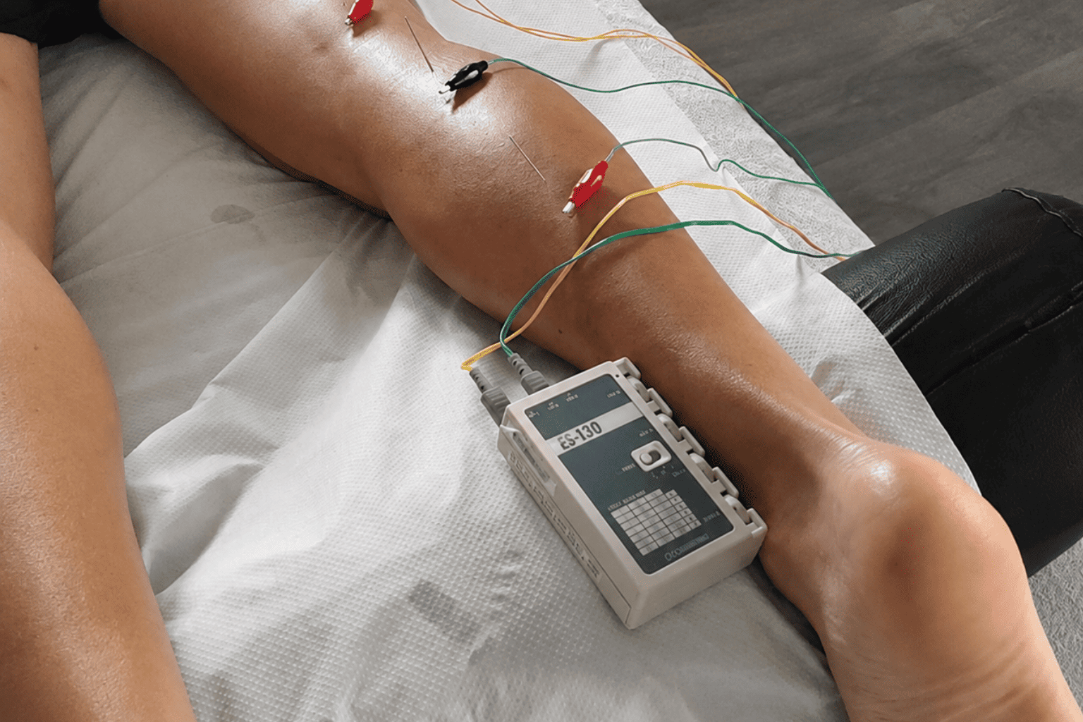 Neuromodulación percutanea en Torremolinos · Centro Ubud